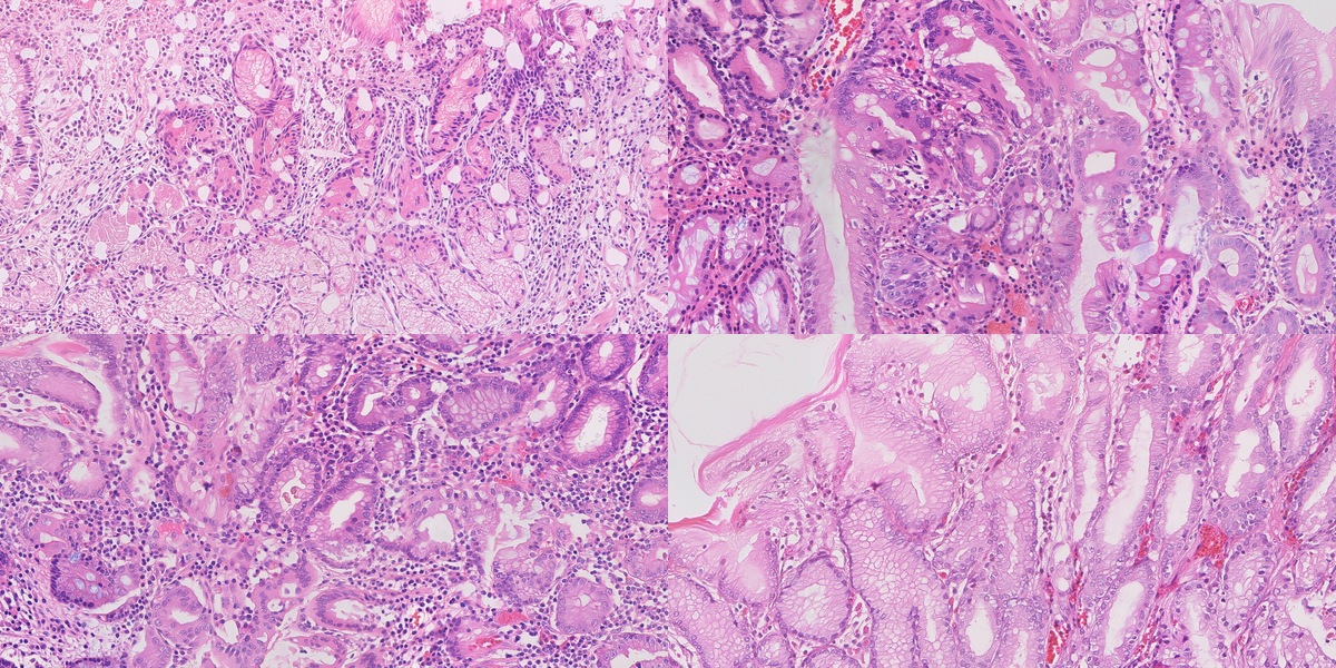 Four synthetic gastric H&E fields representing the challenge targets