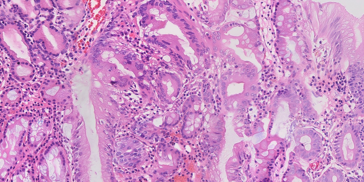 Synthetic gastric H&E image 05: Intestinal metaplasia