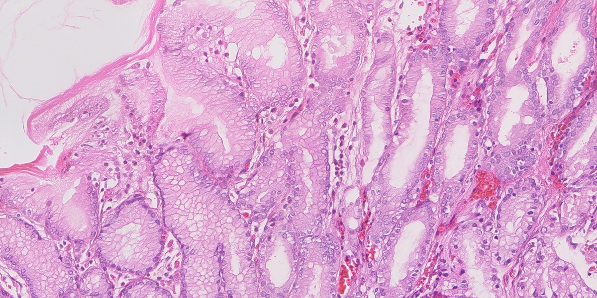 Synthetic gastric H&E image 08: Normal control