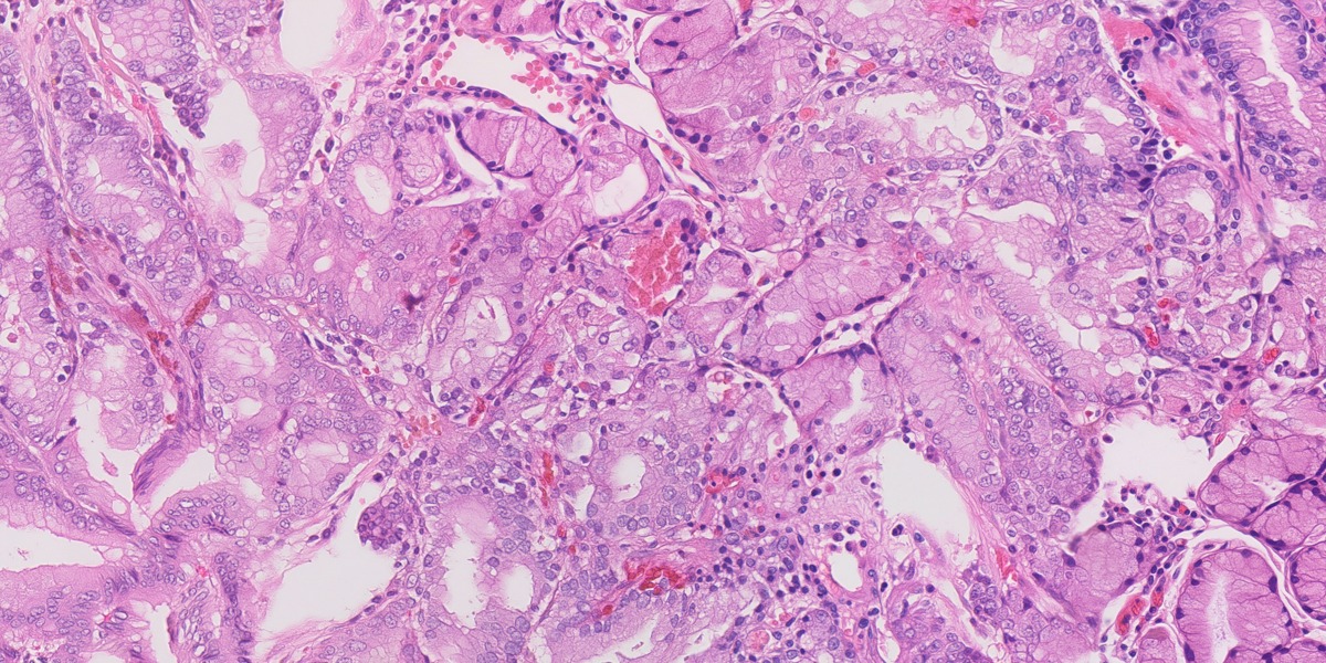 Synthetic gastric H&E image 09: Normal control