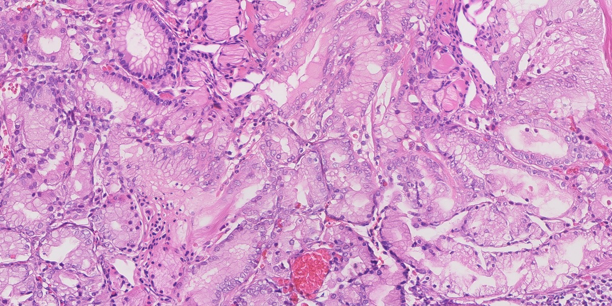 Synthetic gastric H&E image 10: Normal control